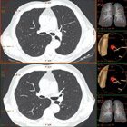 COncology Applications